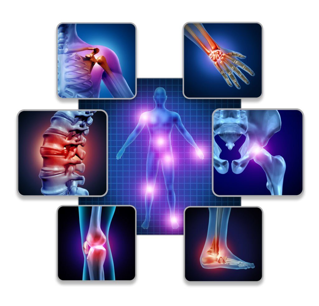 Formas sencillas de combatir la artritis