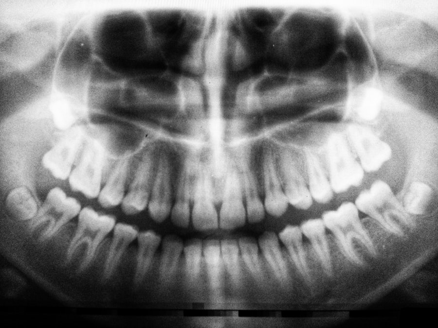 Prevención de accidentes cerebrovasculares: consejos importantes